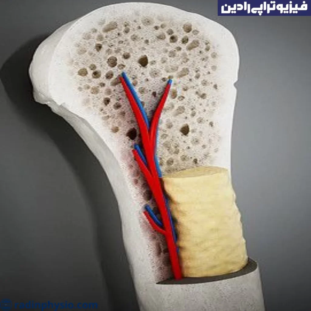پوکی استخوان در یائسگی