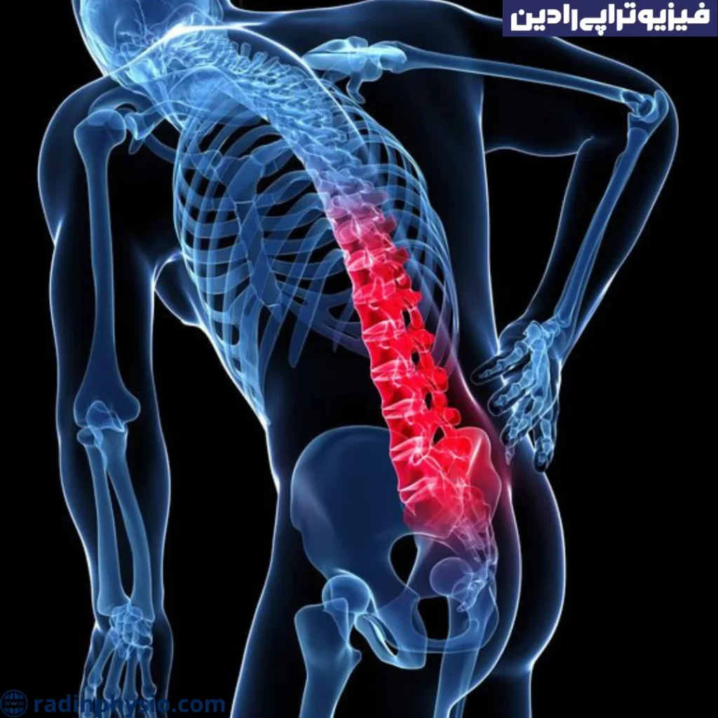 عمل جراحی لامینوتومی