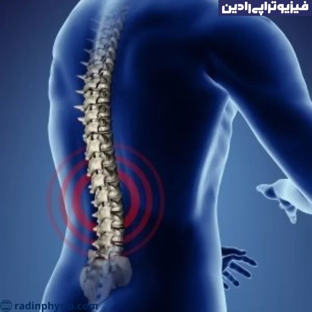 دیسکتومی (Discectomy)