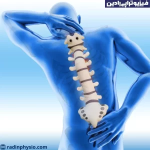 فیزیوتراپی ستون فقرات