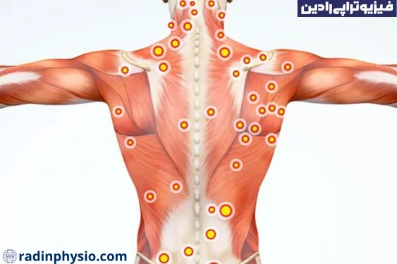 علت ایجاد نقاط ماشه ای