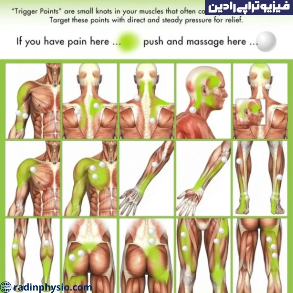 درد عرضی