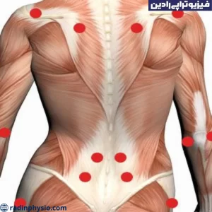 تریگر پوینت
