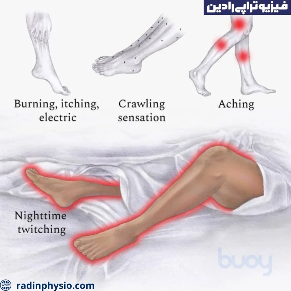 سندروم پای بیقرار