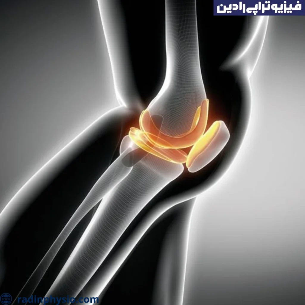 ورید واریس