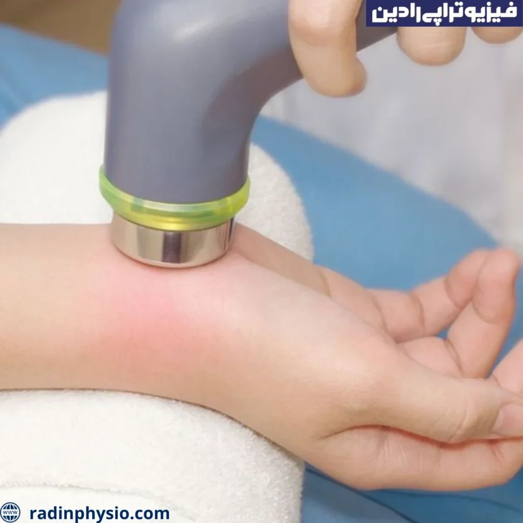 القای آلتراسوند تراپی با استفاده از ژل