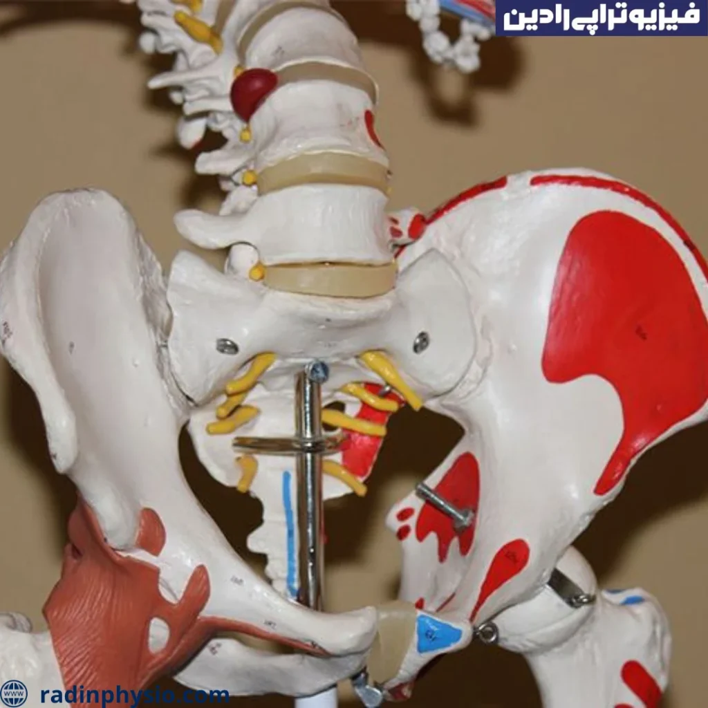 گرفتگی لگن در یائسگی