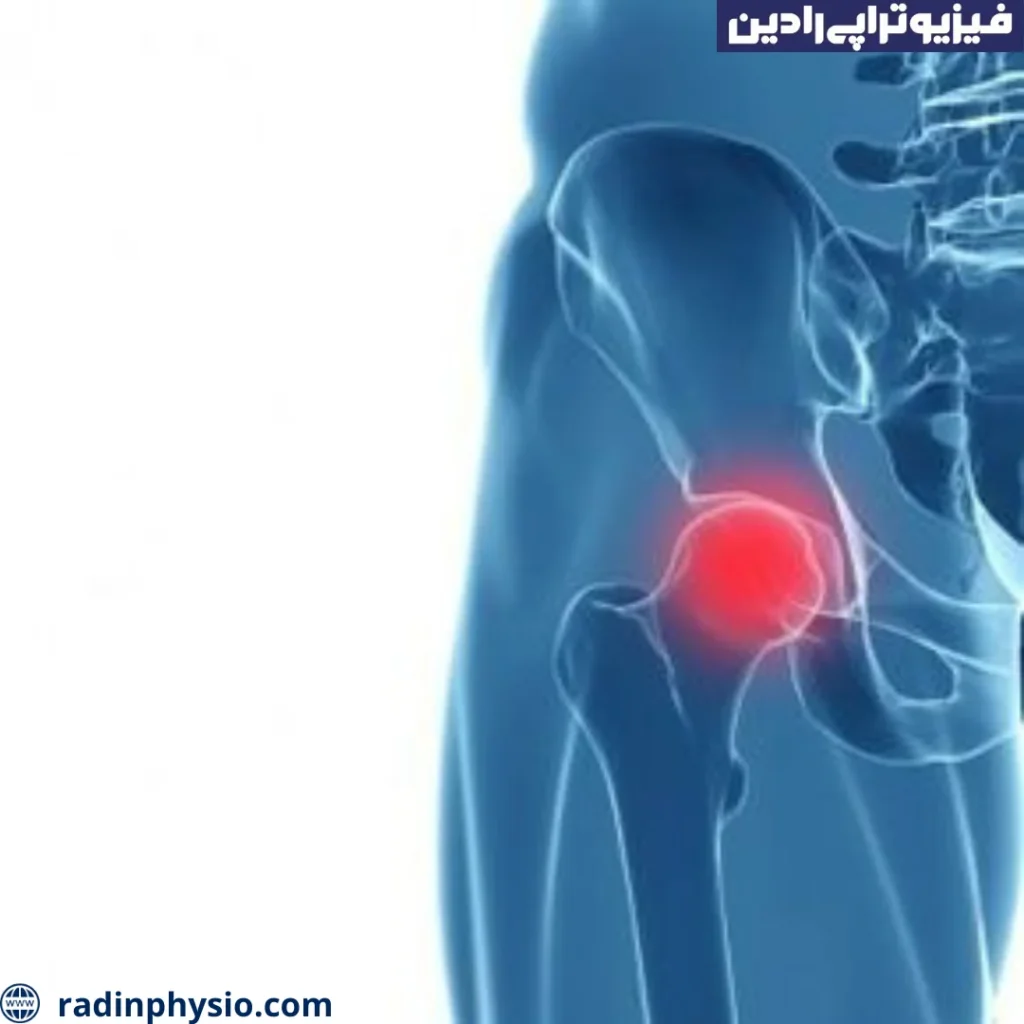 درد لگن در زنان یائسه