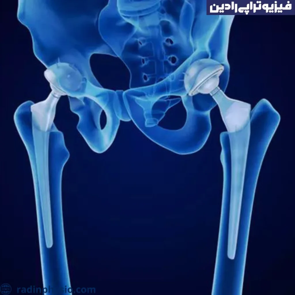 درد لگن در دوران بارداری