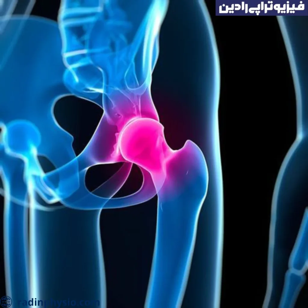 درمان درد لگن در زنان