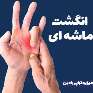 فیزیوتراپی انگشت دست انگشت ماشه ای (تریگر فینگر)