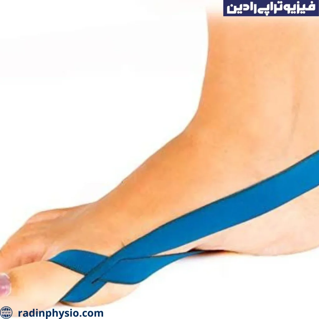 بونیون