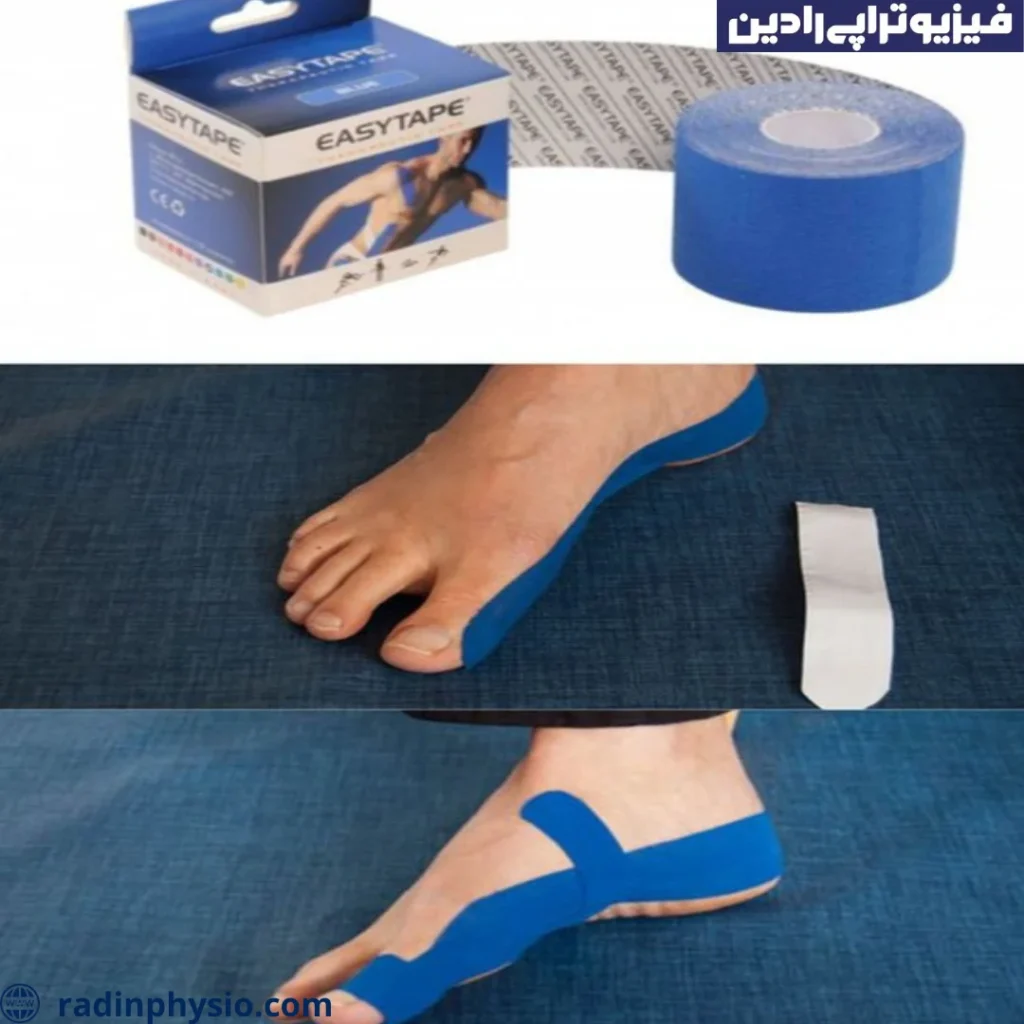 علائم انحراف شست پا