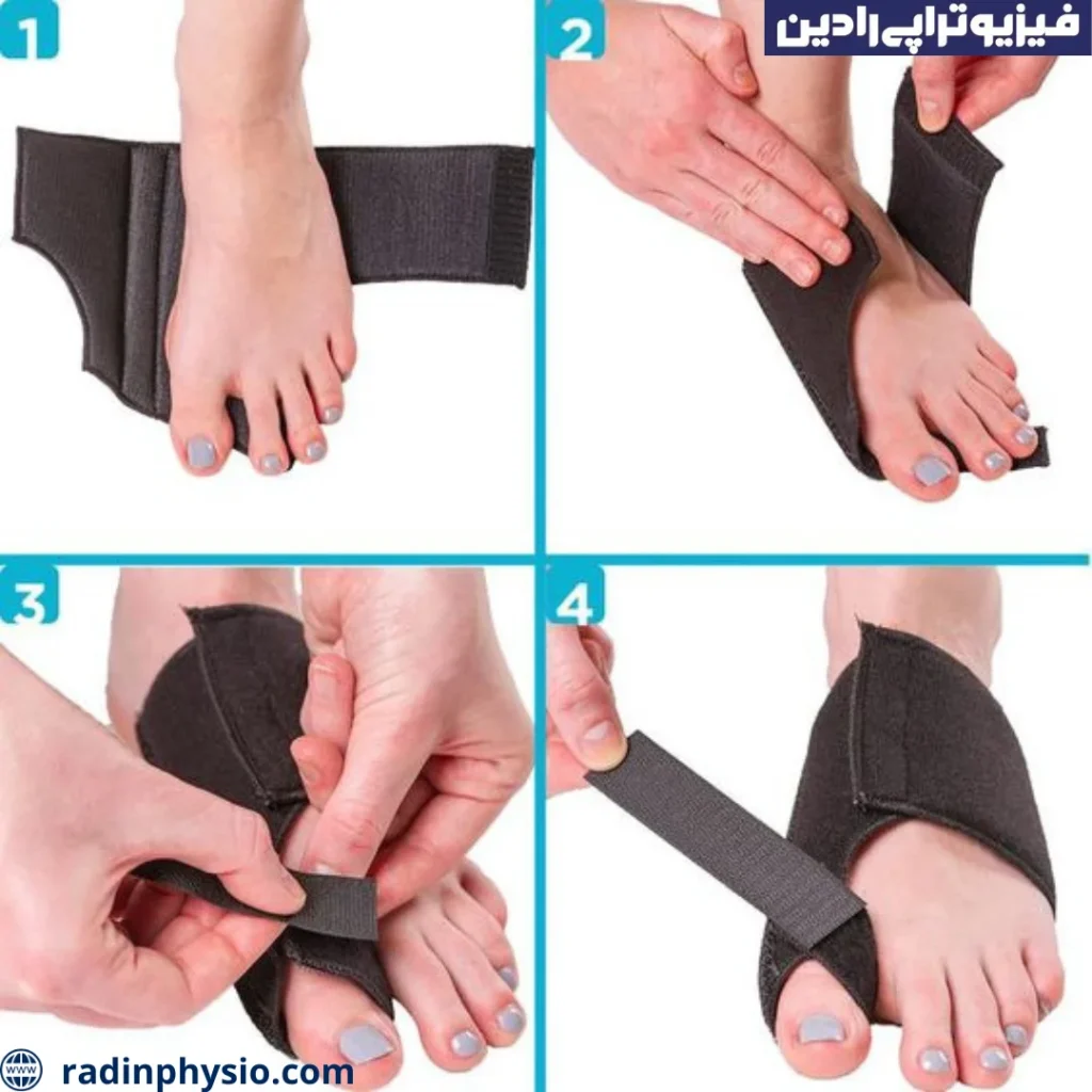کج شدن انگشت شست پا