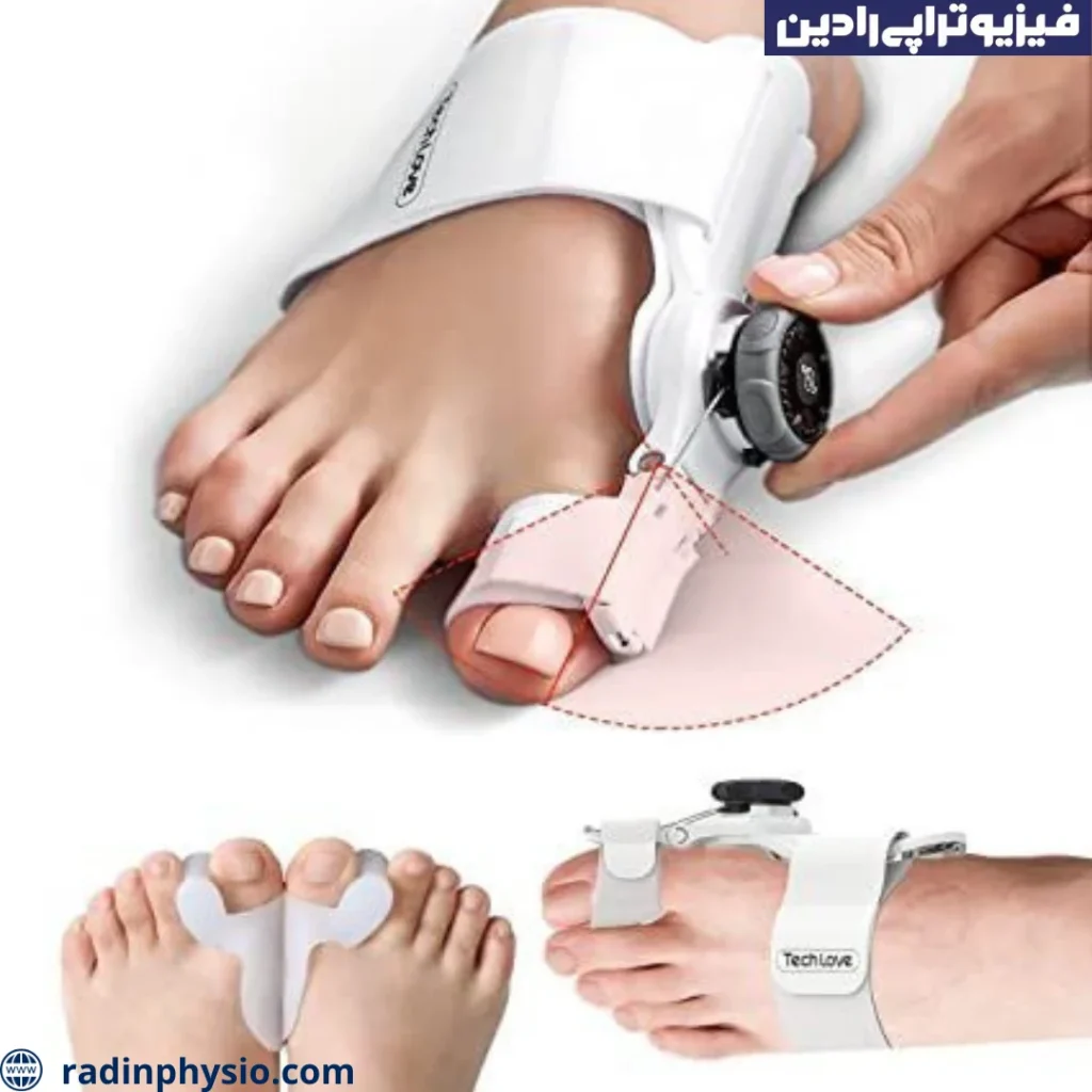 علت کج شدن انگشت شست پا