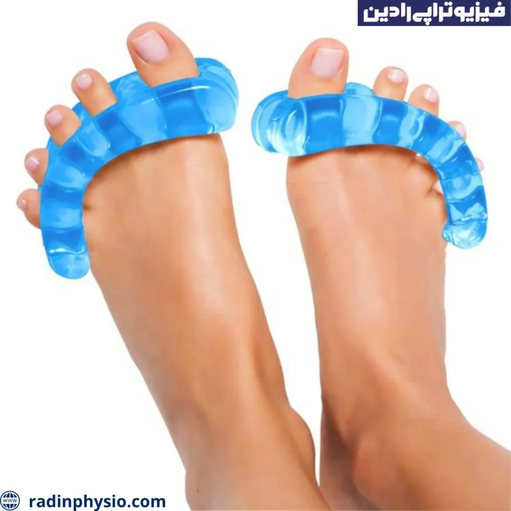 هالوکس والگوس