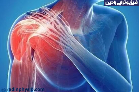 فیزیوتراپی شانه یخ زده