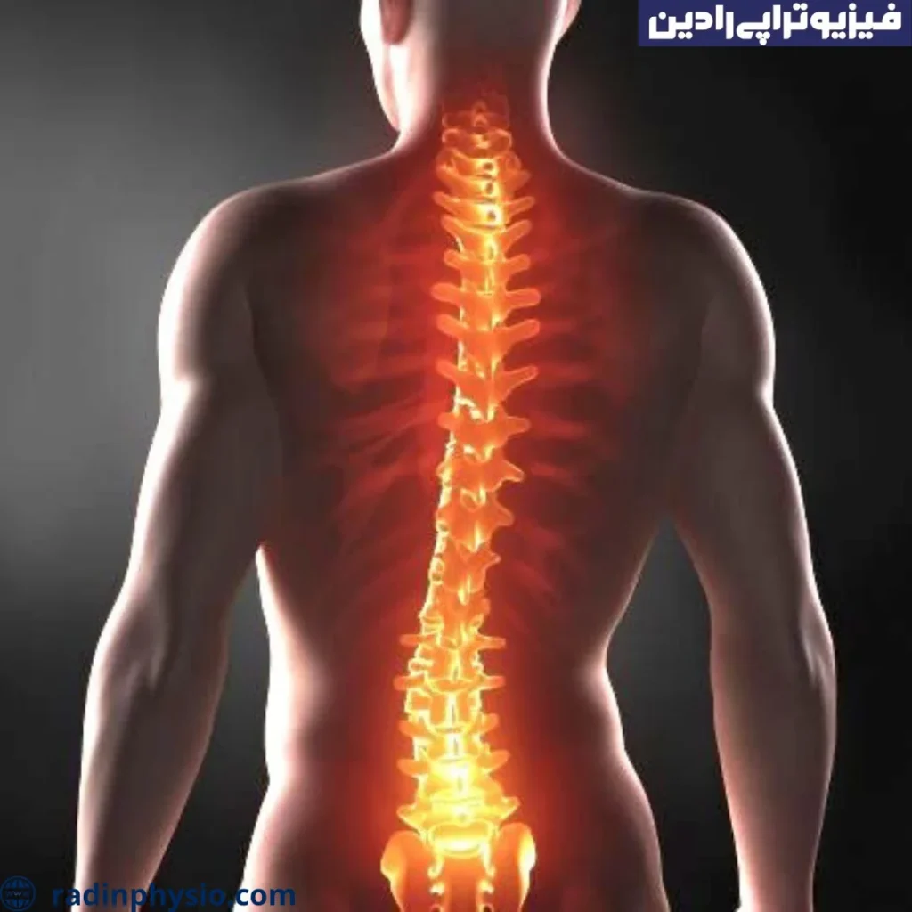 فیزیوتراپی سندروم مفصل فاست ستون فقرات