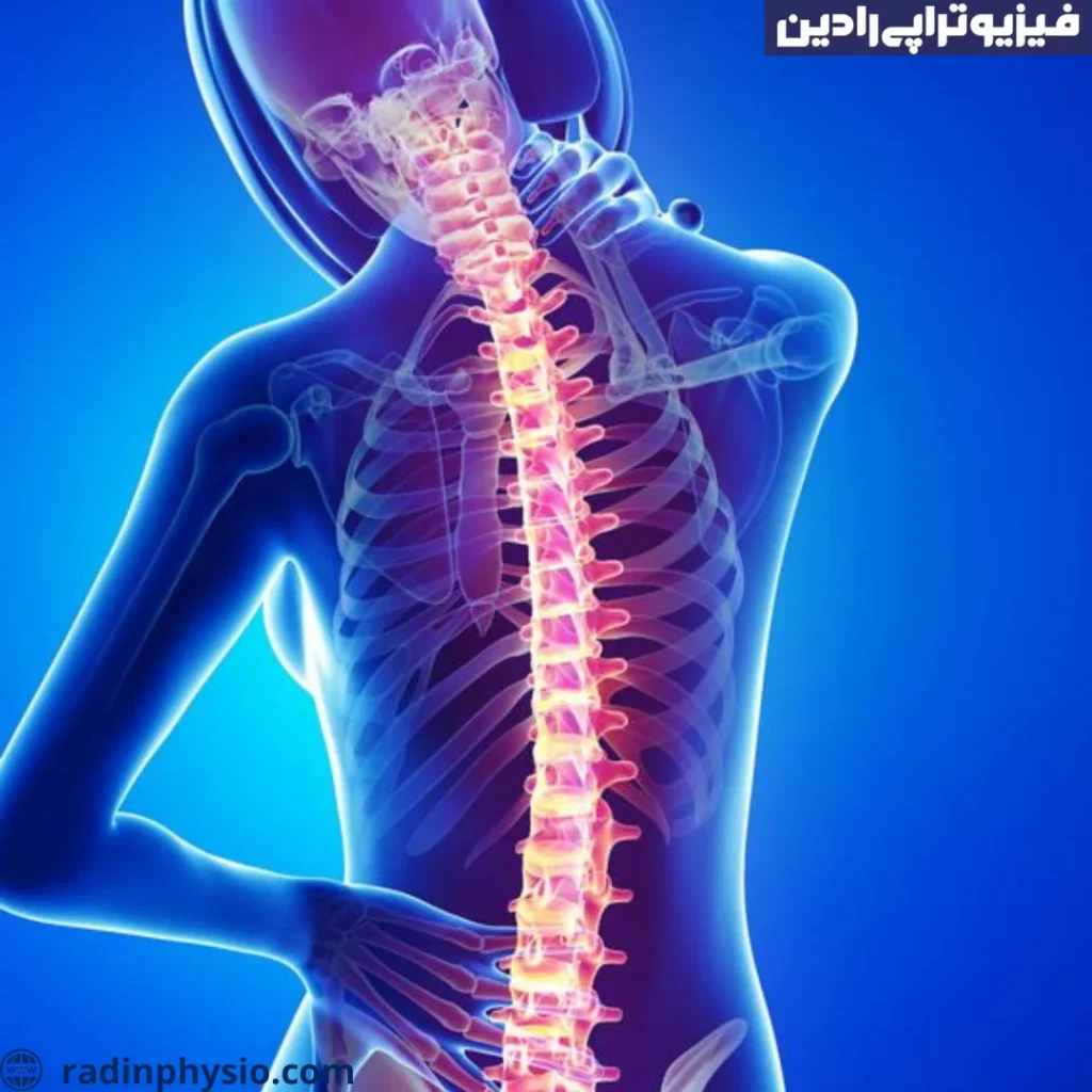 علل آرتروز مفصل فاست ستون فقرات