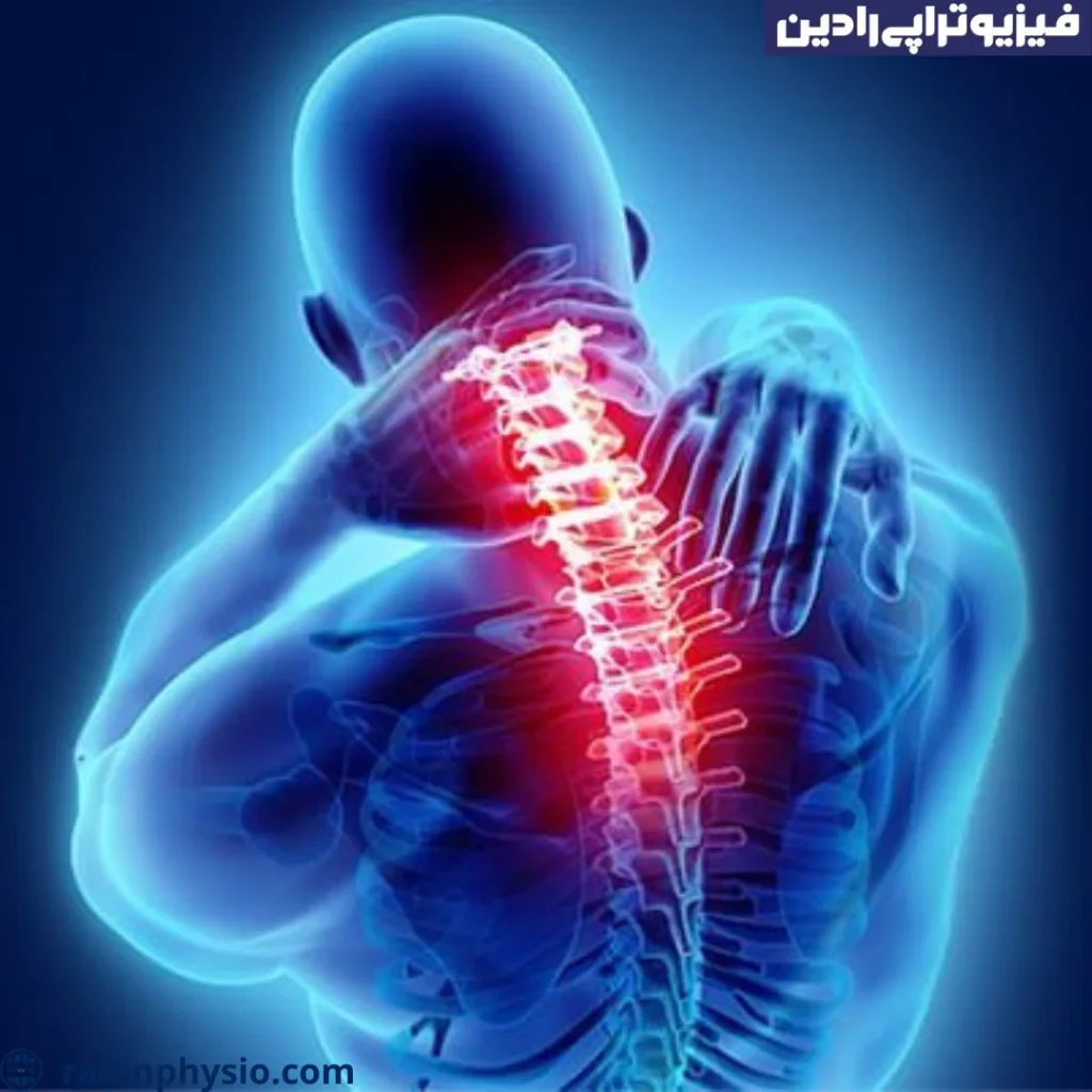 سندرم آنکیلوز