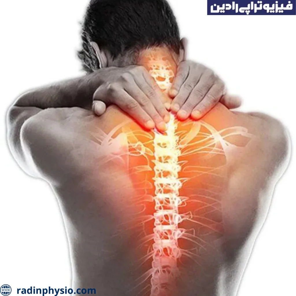 آرتروز مفصل فاست