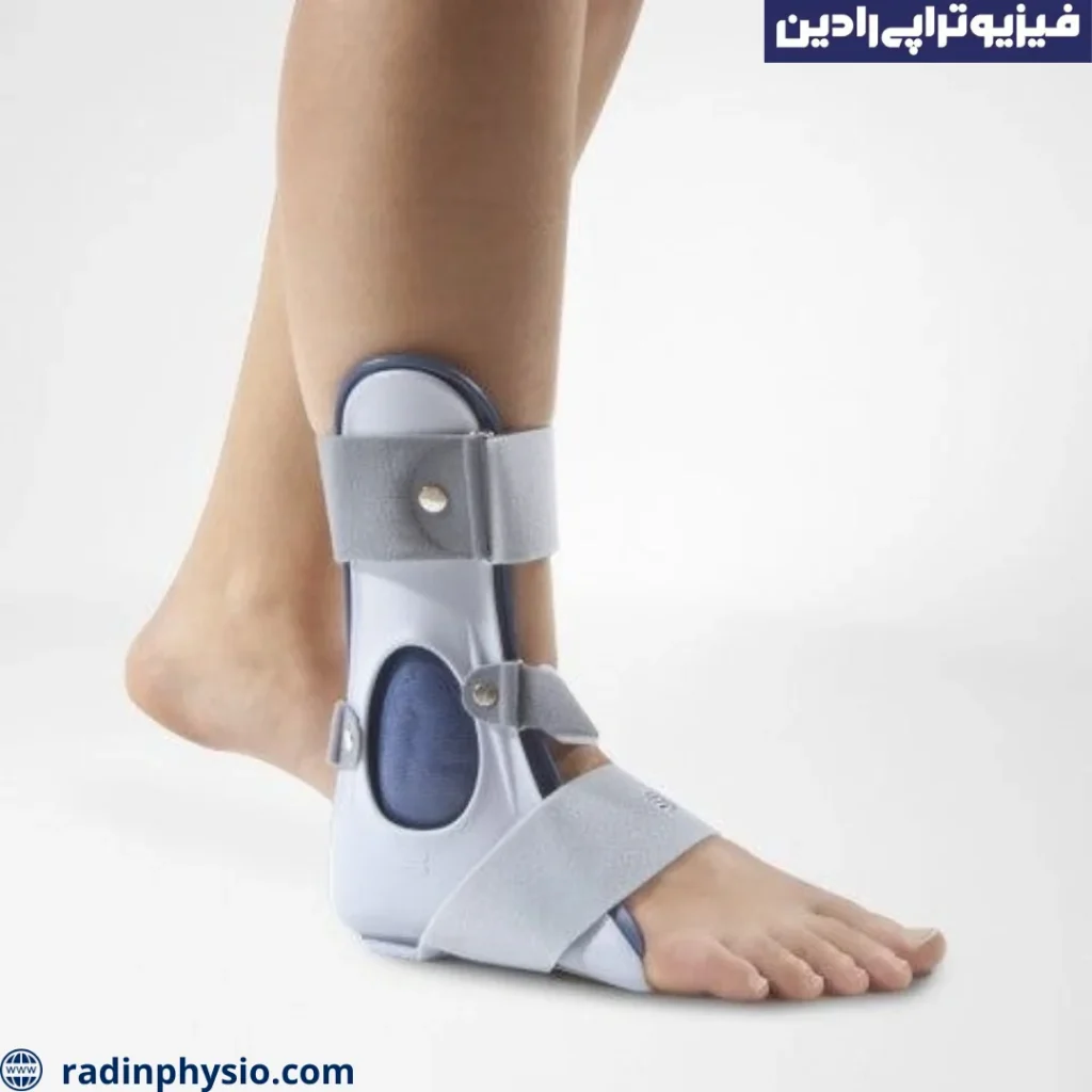 شکستگی استخوانهای فوقانی پاشنه