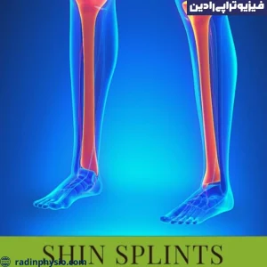 فیزیوتراپی شین اسپلینت
