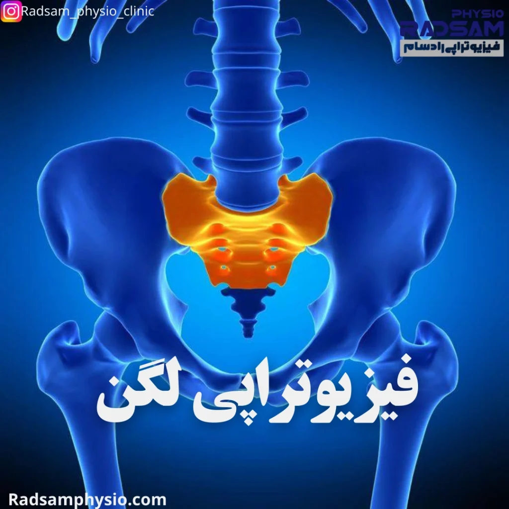 فیزیوتراپی لگن